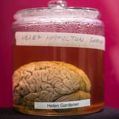 Brain of Helen Hamilton Gardener